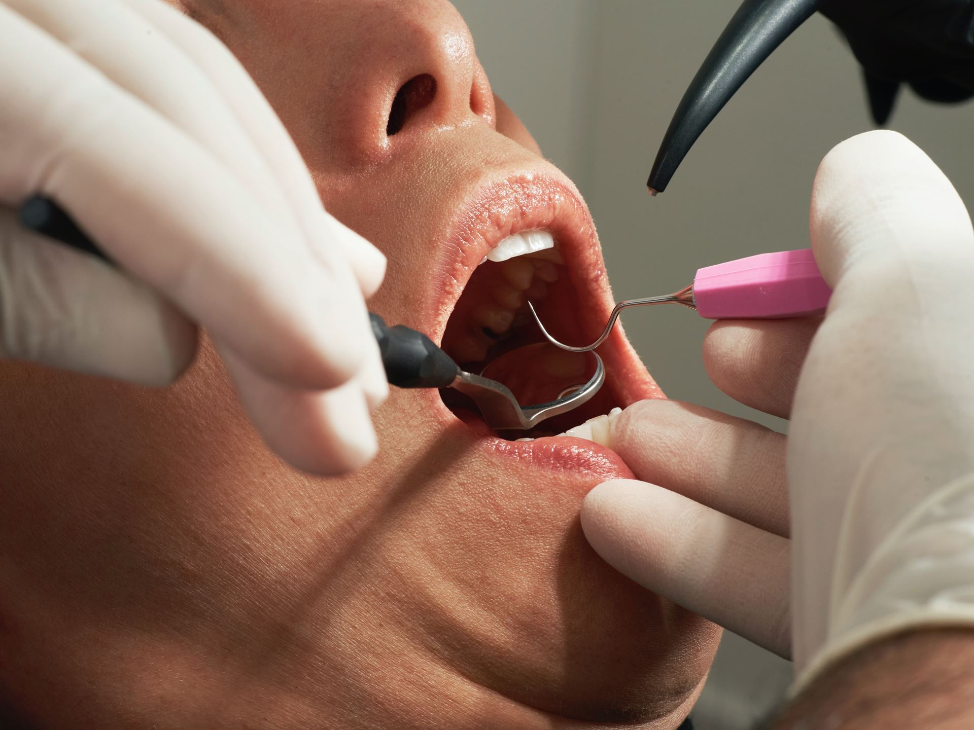 a person getting dental work done